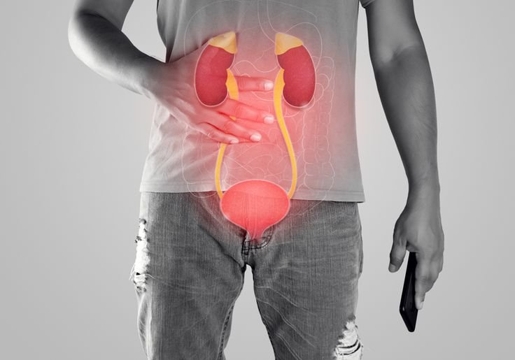 Kidney Stone Treatment