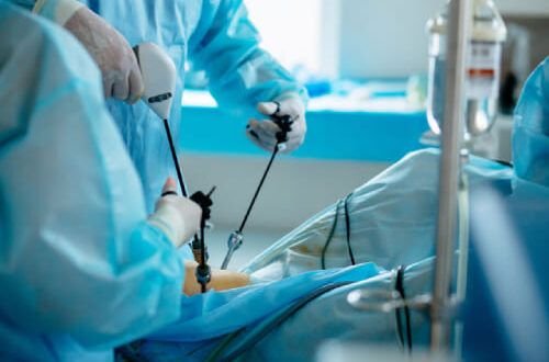 Laparoscopic Urology